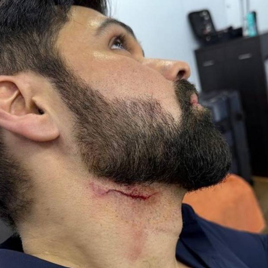 इमरान हाशमी को शूटिंग के दौरान लगी गंभीर चोट:एक्शन सीन शूट कर रहे थे एक्टर, तेलुगु फिल्म गुडाचारी-2 में आएंगे नजर